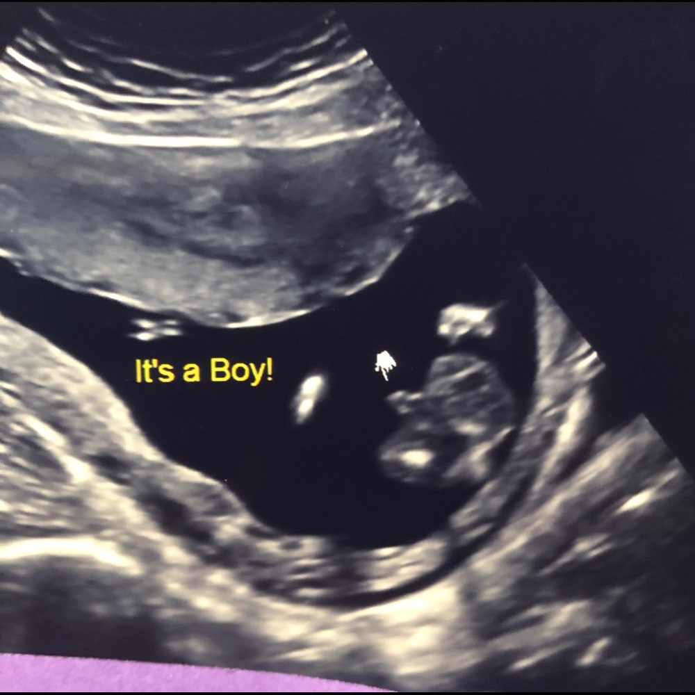 Making room for baby #2!!!
